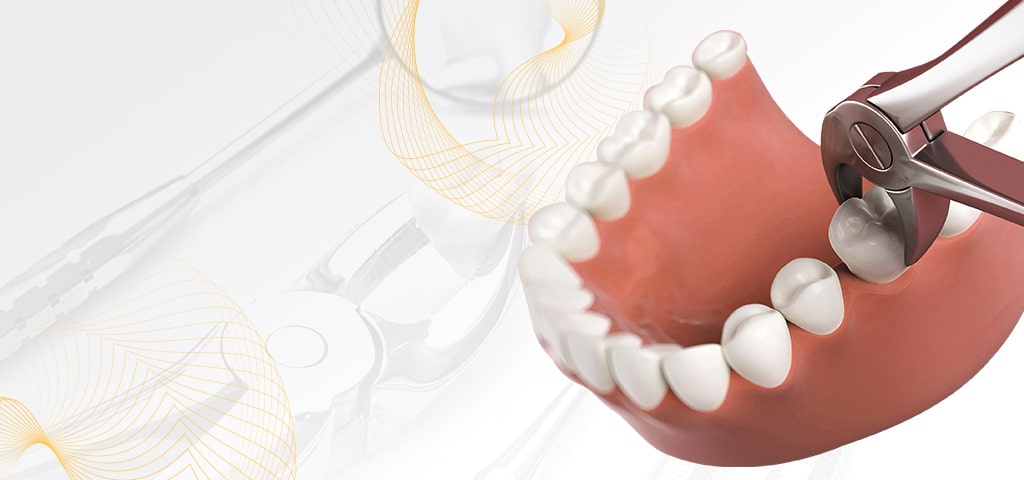 Скидка на удаление зубов при имплантации